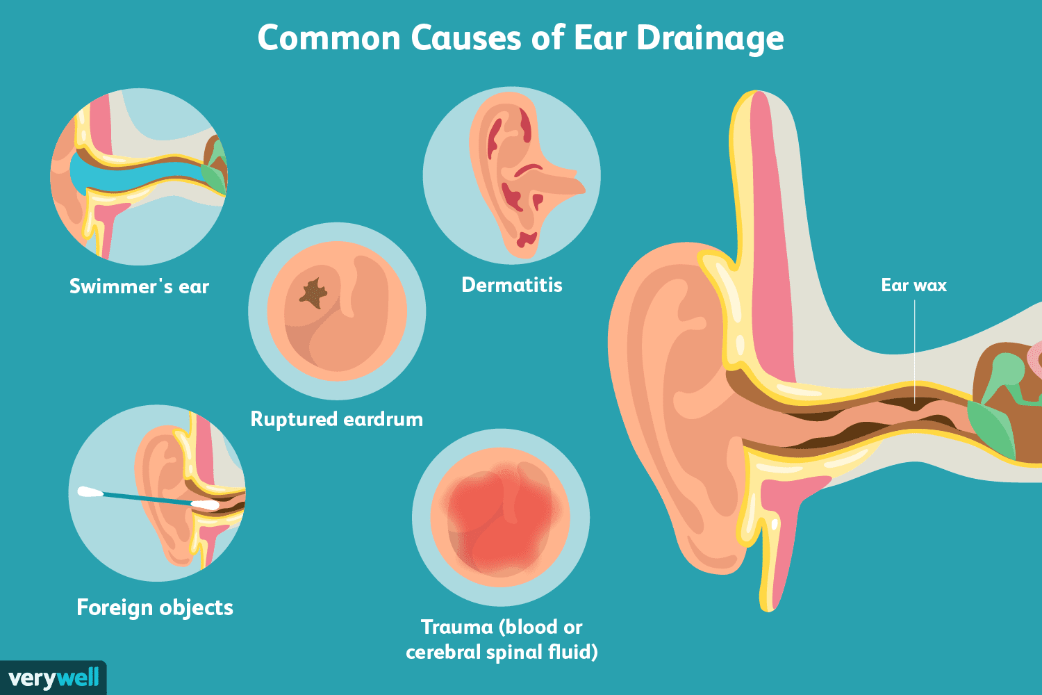 Understanding Ear Fluttering: Causes, Symptoms, and Remedies